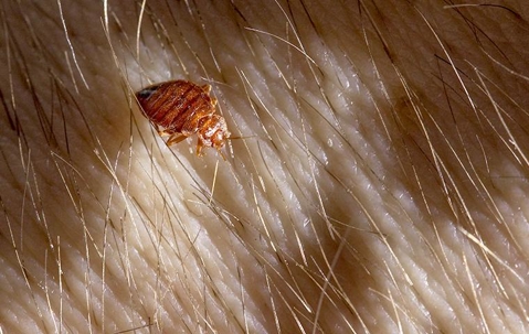 a bed bug crawling on human skin